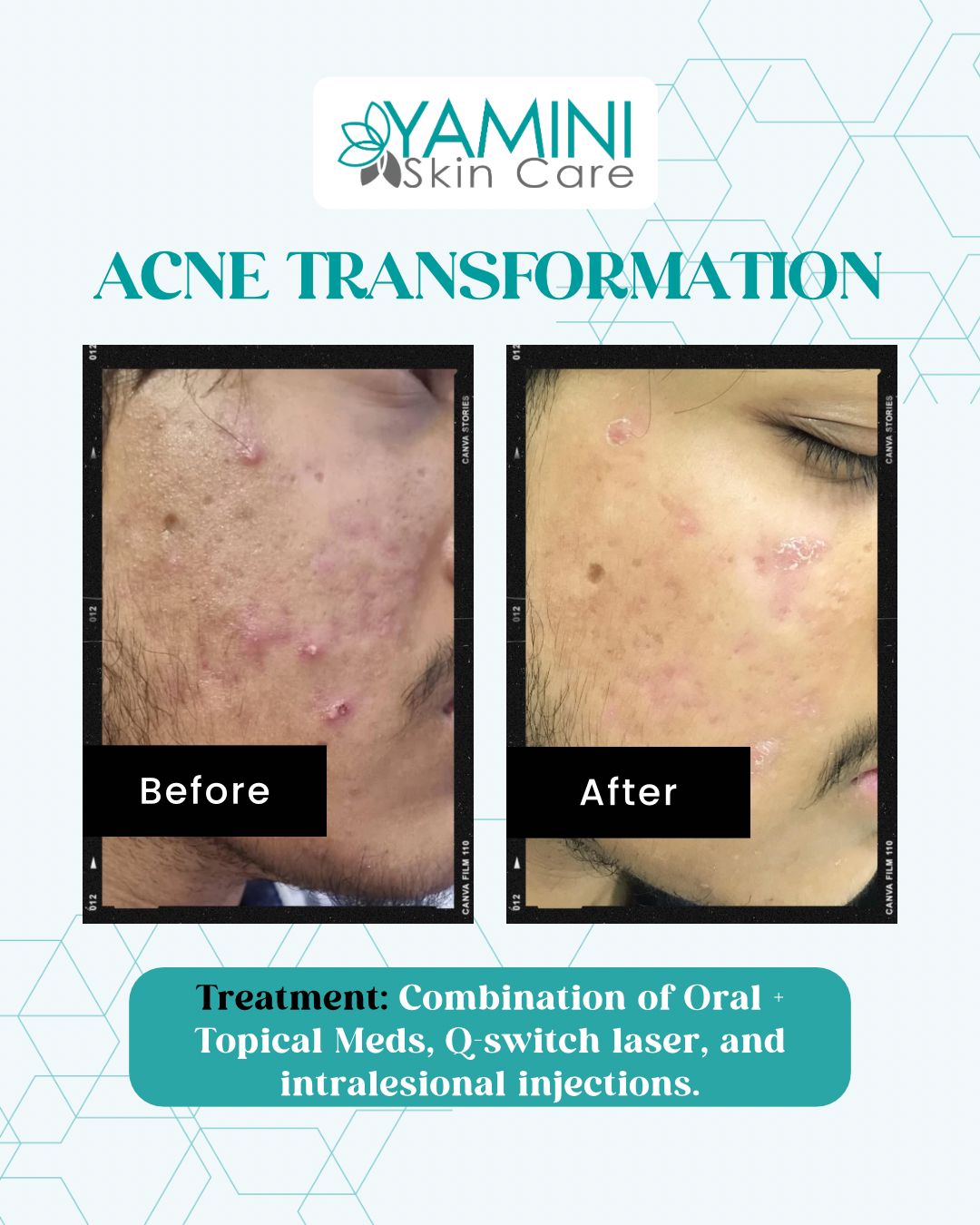 Before and After Treatment