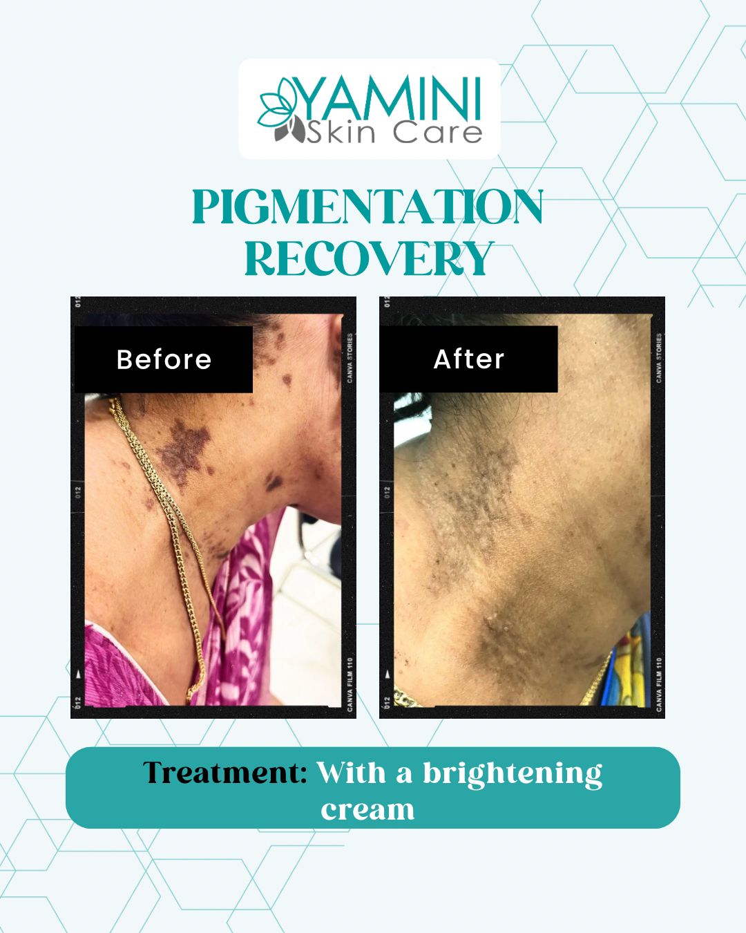 Before and After Treatment