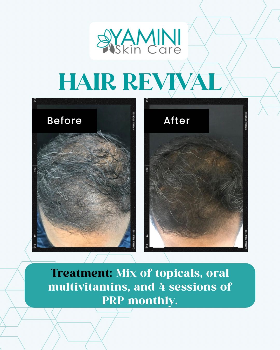 Before and After Treatment