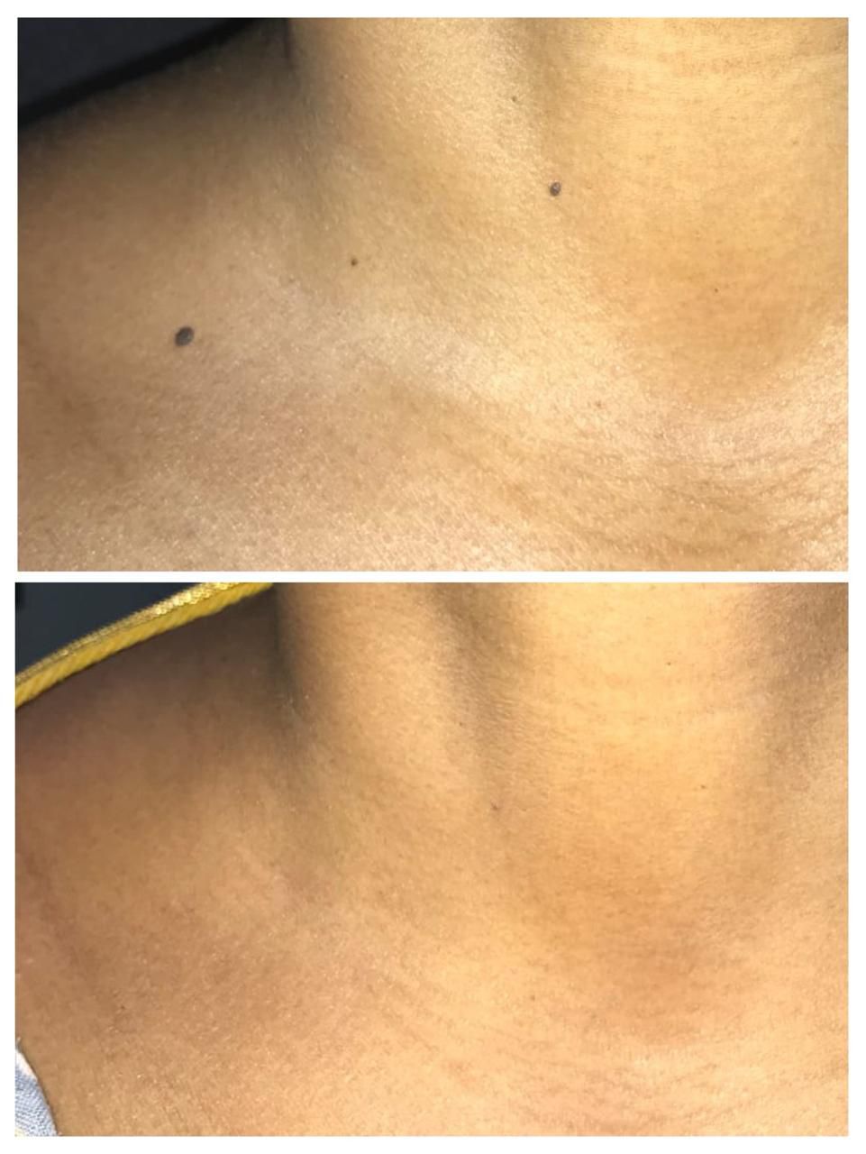 Before and After Treatment